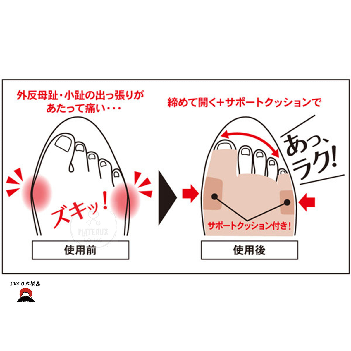 拇趾外翻矯正墊