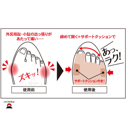 拇趾外翻矯正墊